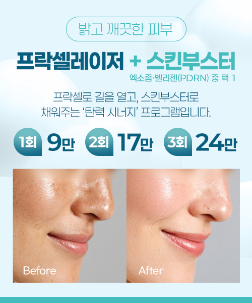 프락셀레이저+스킨부스터